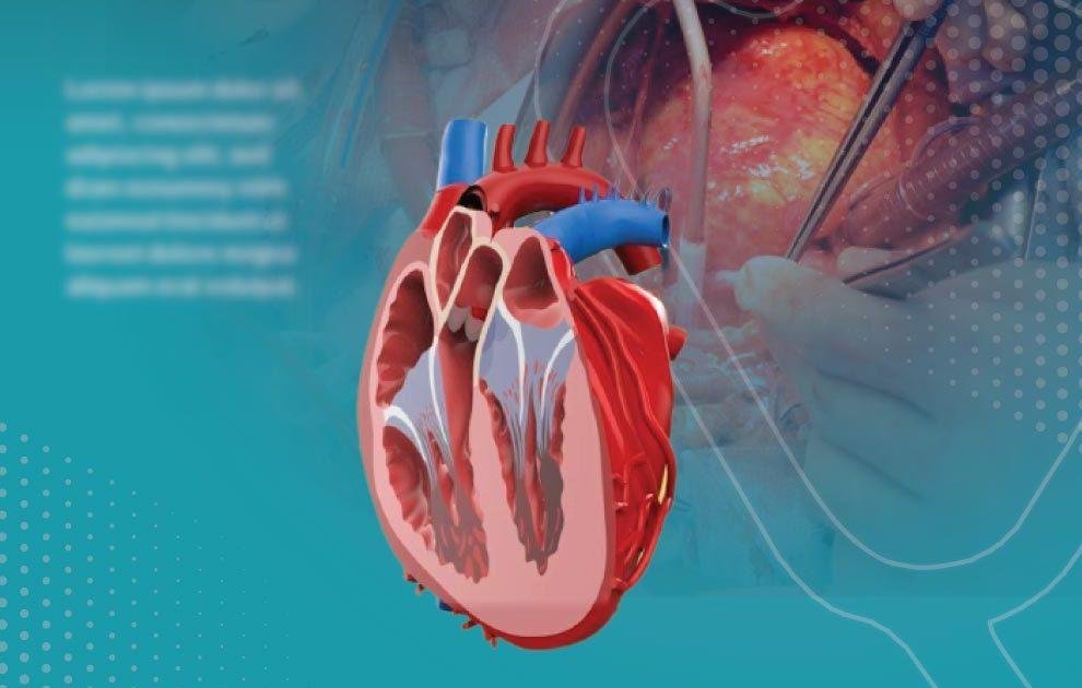 عيادة الدكتور وليد اسماعيل - جراحة قلب الاطفال