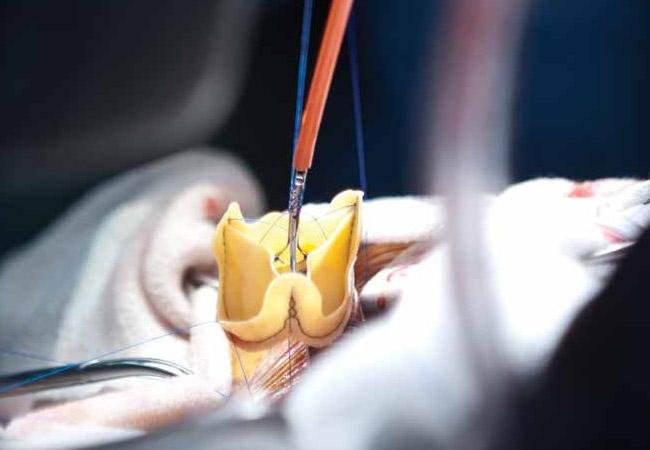 عيادة الدكتور وليد اسماعيل - جراحة قلب الاطفال