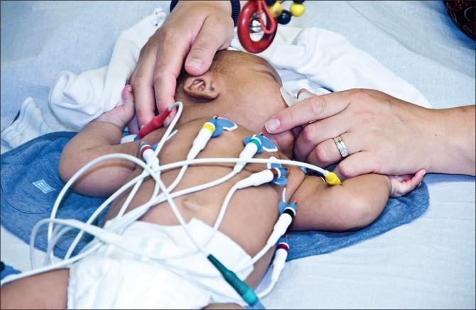 عيادة الدكتور وليد اسماعيل - جراحة قلب الاطفال