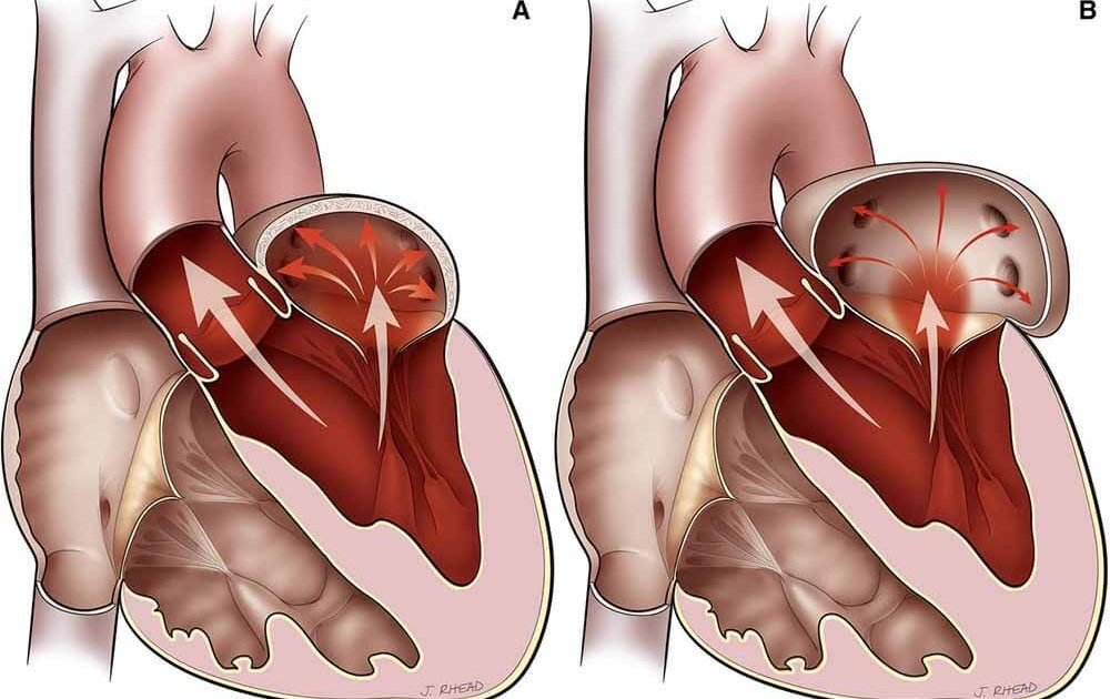 عيادة الدكتور وليد اسماعيل - جراحة قلب الاطفال